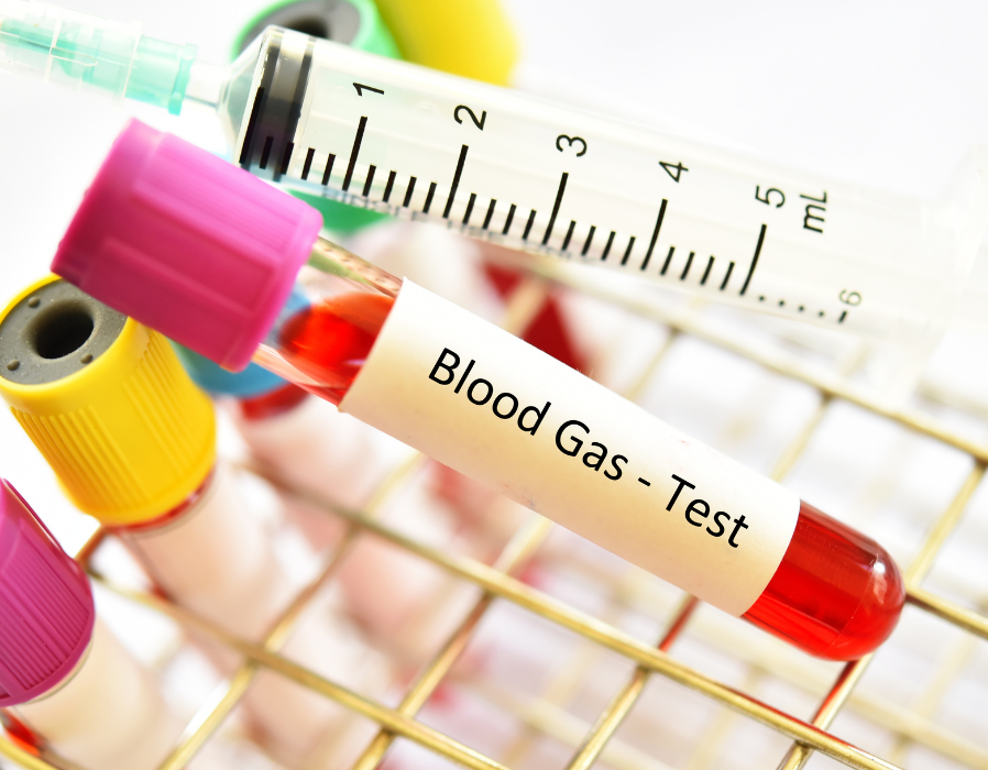 Kidney Function Test (KFT)