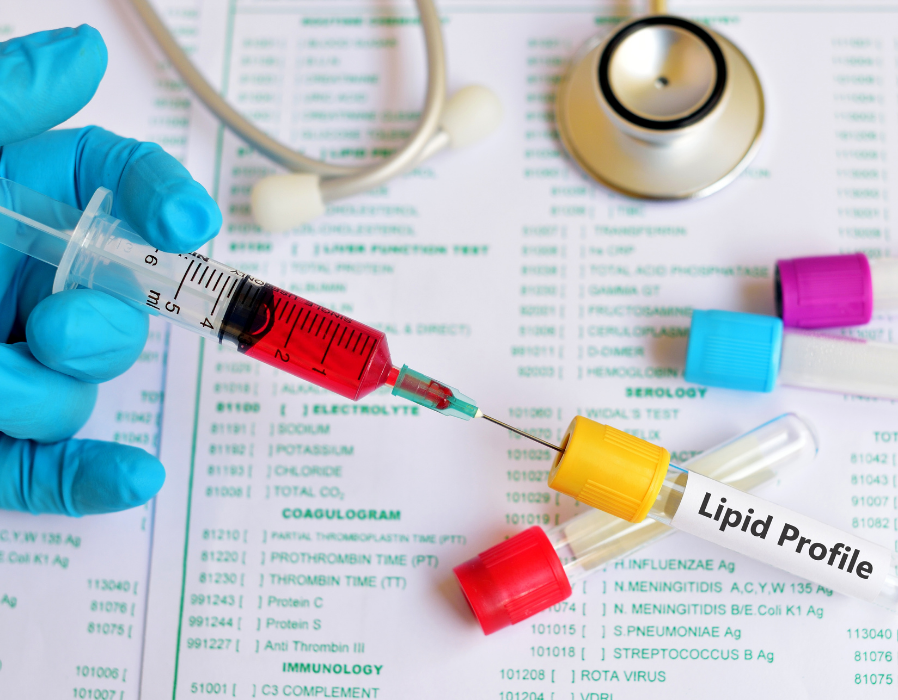 Lipid Profile Test