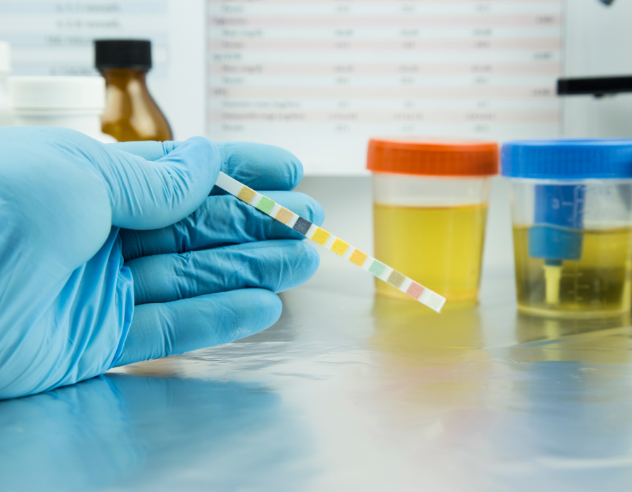 Urine Routine & Microscopy